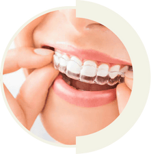 Transparent Invisalign® aligners for comfortable and invisible orthodontic treatment