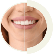 Gum disease treatment and periodontal care for healthy supporting tissues