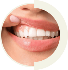 Gum contouring and gingival esthetics for balanced, healthy smiles