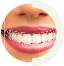 Digital Smile Design technology for personalized smile transformations