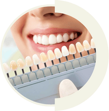 Perfect Hollywood Smile design by Master of Dent cosmetic dentists in Istanbul