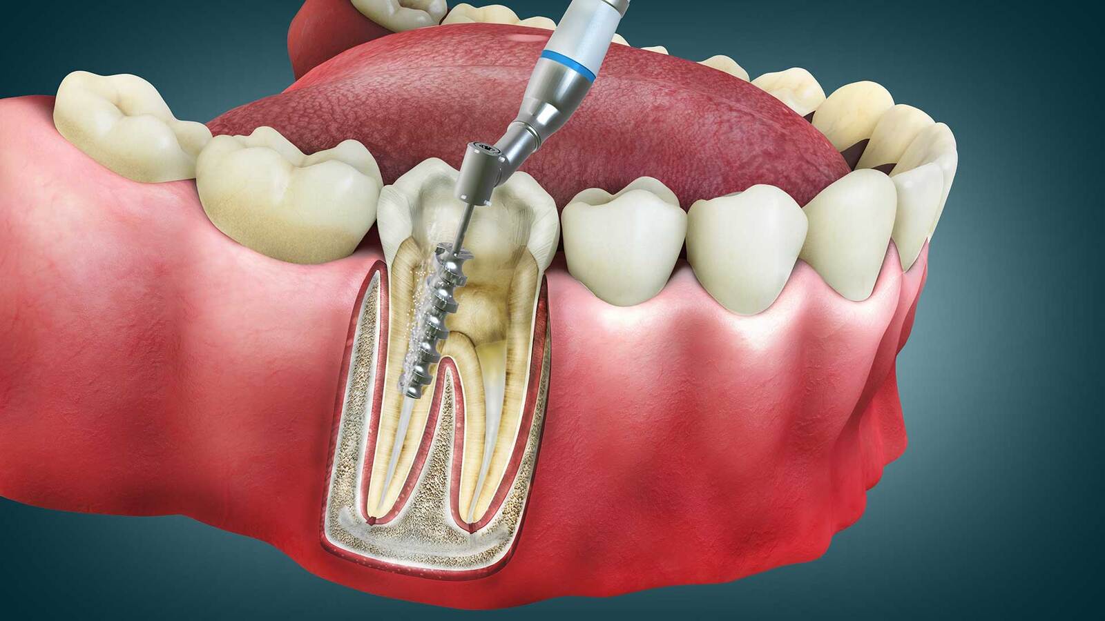 Comprehensive dental treatments at Master of Dent Clinic in Istanbul, including aesthetic dentistry, implants, orthodontics, and general care.
