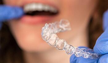 Advanced orthodontic treatments for straight, healthy teeth at Master of Dent