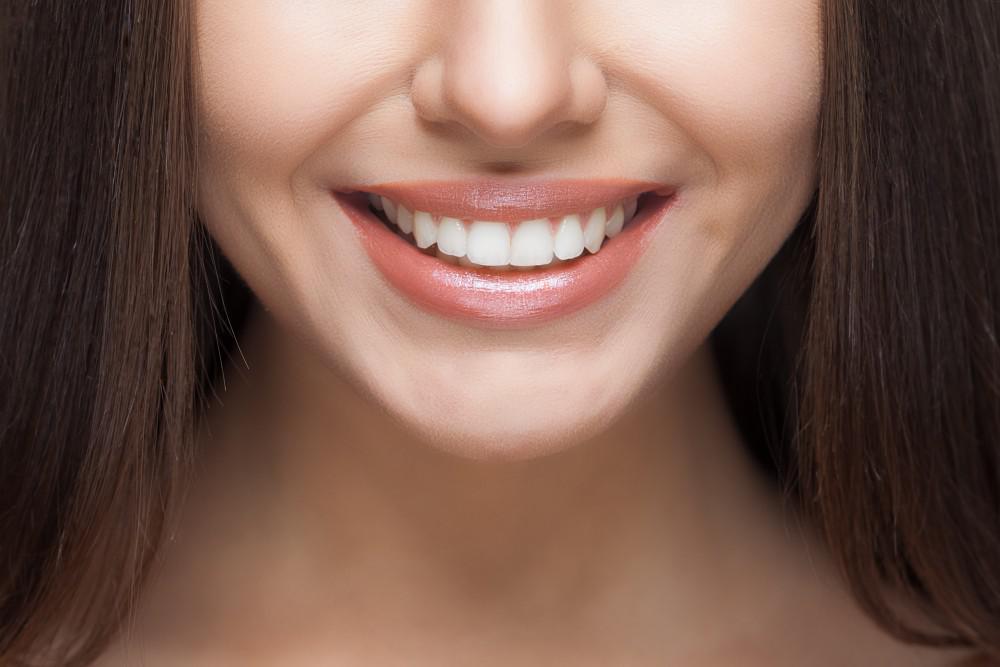 Perfect Hollywood Smile design by Master of Dent cosmetic dentists in Istanbul